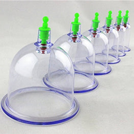 Cupping therapy