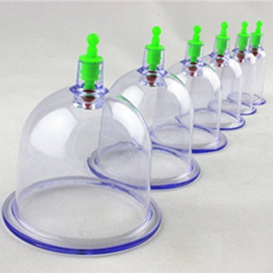 Cupping therapy